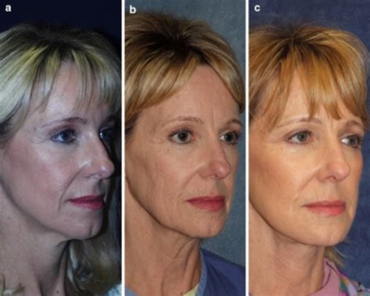 Do personalities change over time?