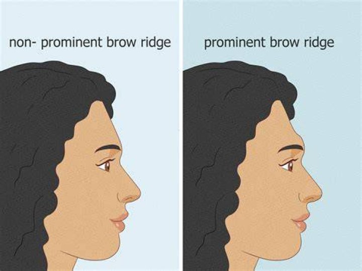 Why do I have a brow ridge?