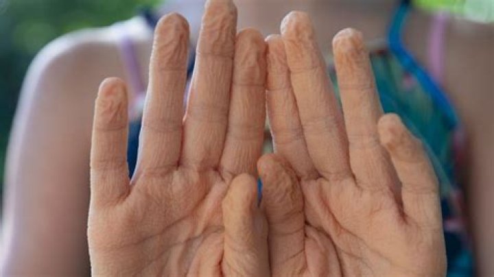 Why do my hands get wrinkly in water so fast?